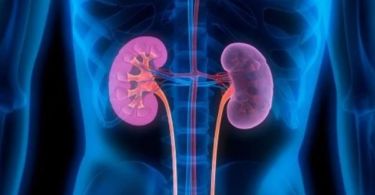 LGA nephropathy: what is it and why does it occur?